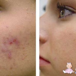 Чистка/Массаж лица