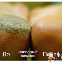  ПЕДИКЮР - МЕДИЦИНСКИЙ ,АППАРАТНЫЙ, обрезной 