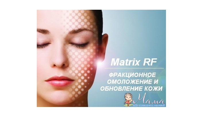 Процедура Matrix RF: молодость без пластических операций!