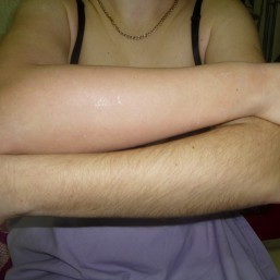 Депиляция сахарной пастой ШУГАРИНГ