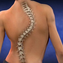 Тренировки: заболевания позвоночника и профилактика